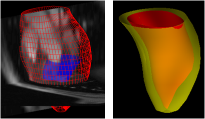 4D Cardiac Segmentation of the Epicardium and Left Ventricle
